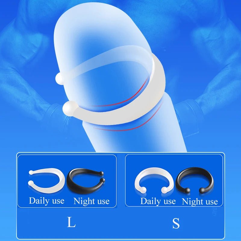 Adjustable buckle or closure detail