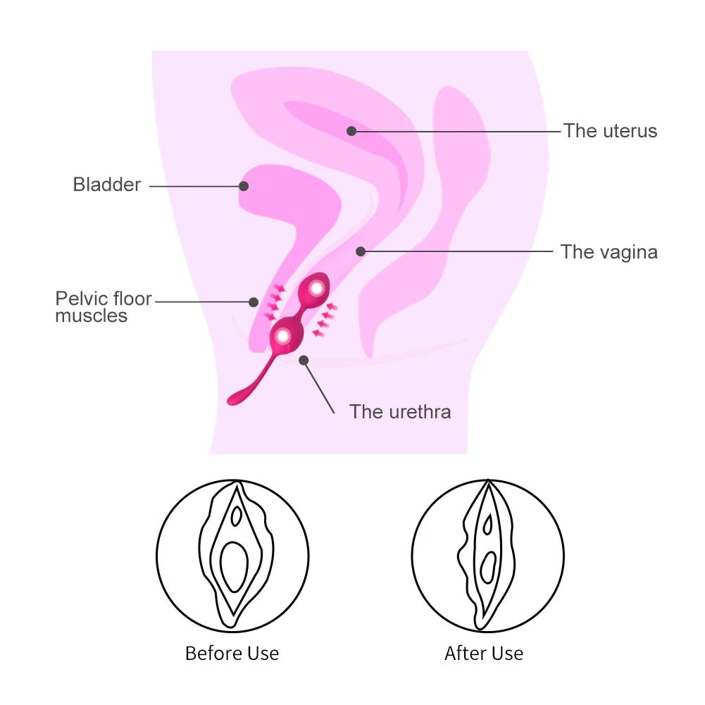 Colour and material options for kegel trainer