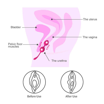 Colour and material options for kegel trainer